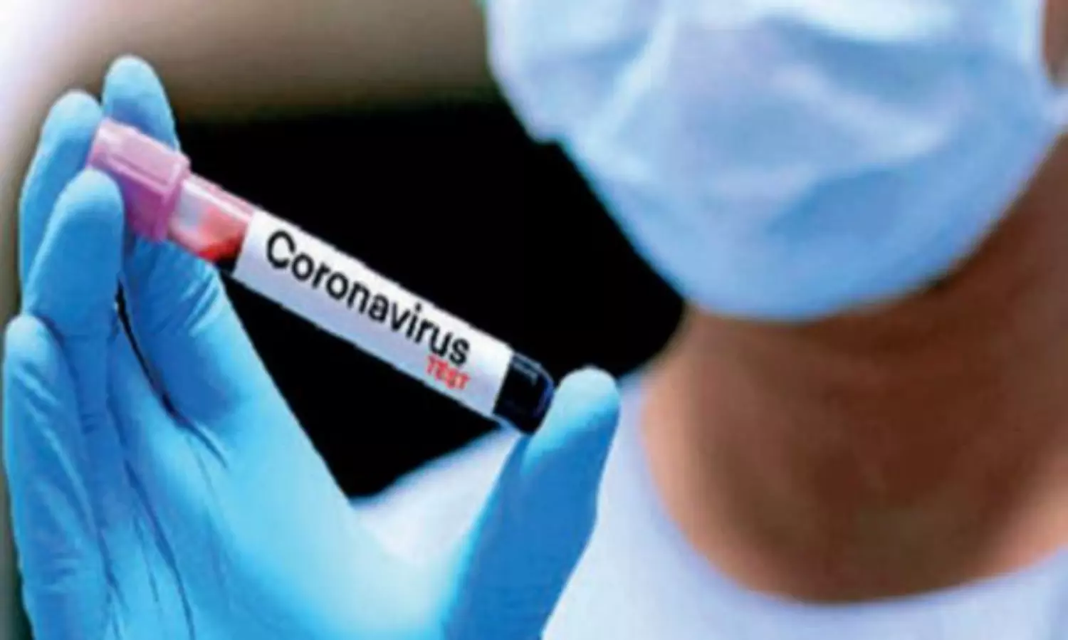 Two more corona deaths, 8 new cases in Agra