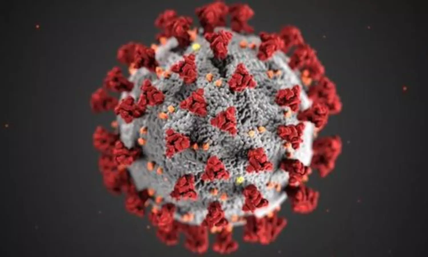 US underprepared for greatest public health crisis in century