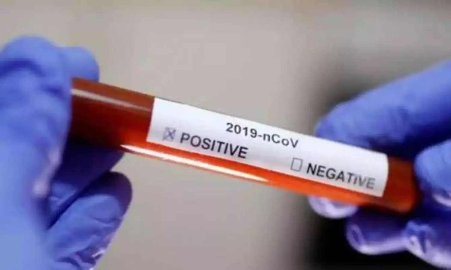 191 UP jail inmates test COVID-19 positive