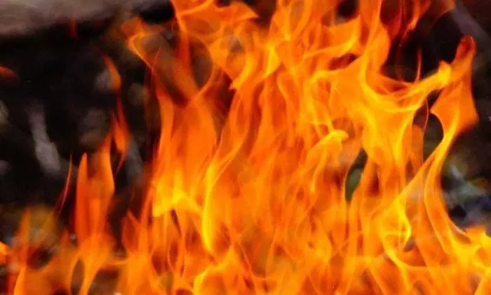 Woman who set herself ablaze in front of UP Assembly, dies