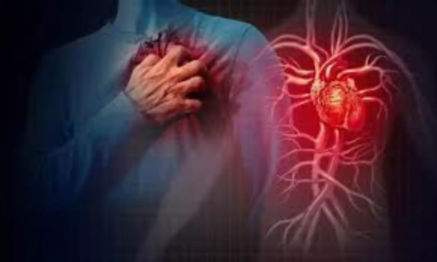 Are 9,000 steps enough to prevent heart attacks in older adults