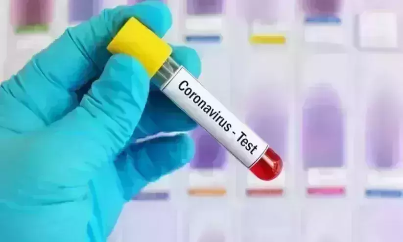 Covid Deaths exceeds 5500 in Saudi Arabia