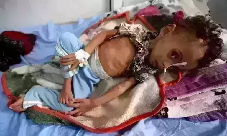 Countdown to catastrophe in Yemen; UN warns of extreme poverty