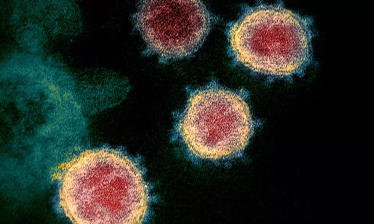 Global Covid-19 caseload tops 132.9 million