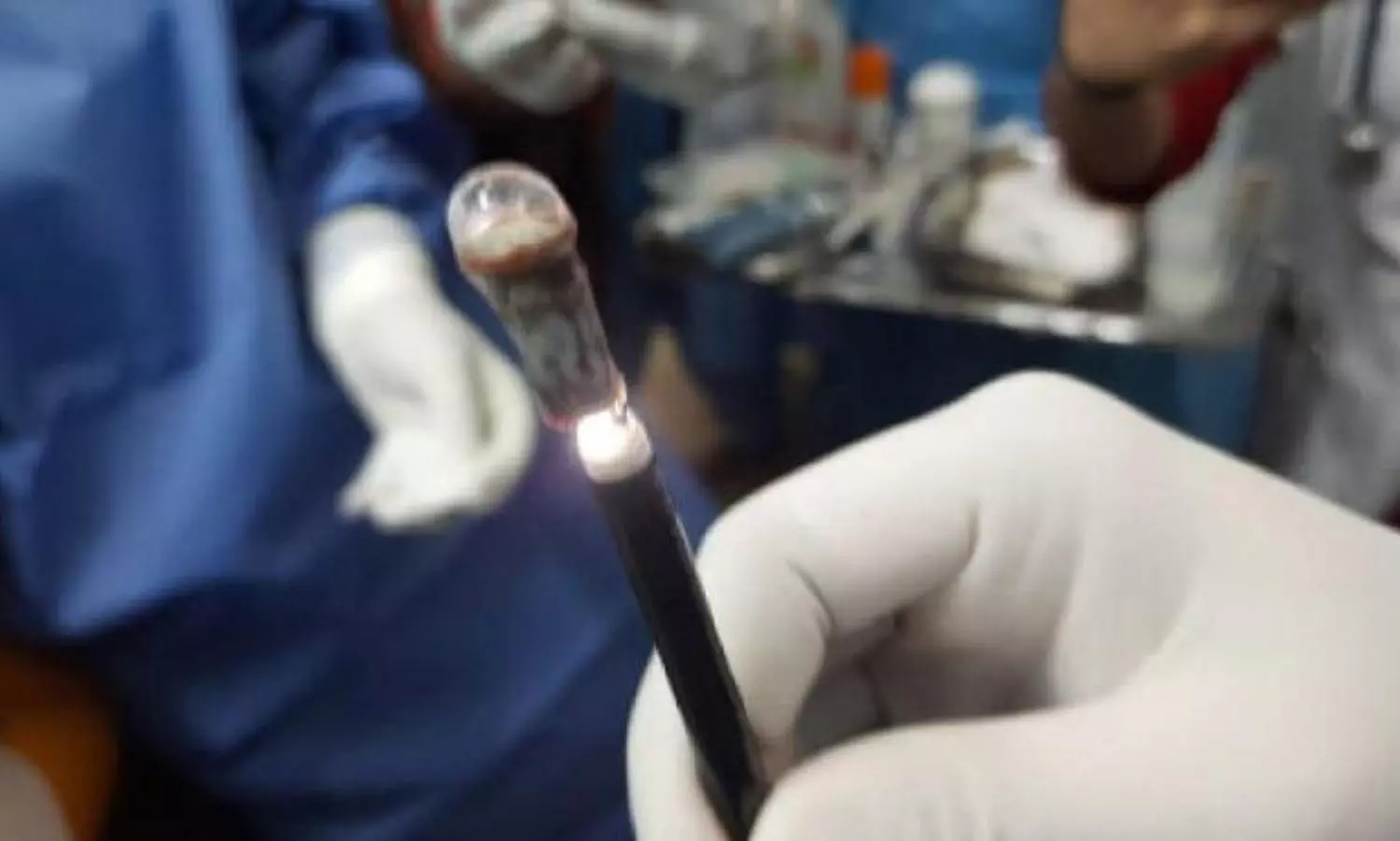 Trapped whistle pulled out of womans windpipe after 25 years