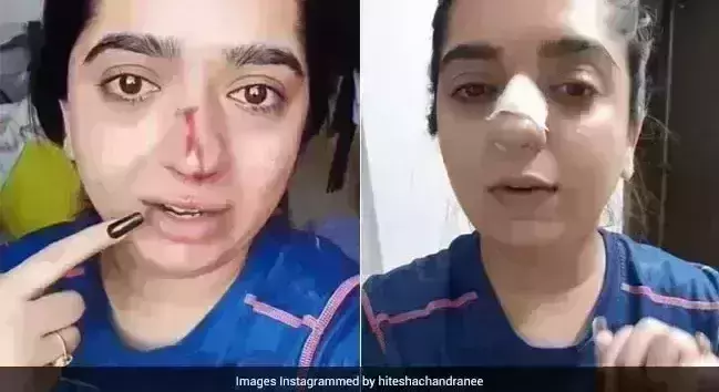 Zomato delivery boy arrested for assaulting Bengaluru female customer