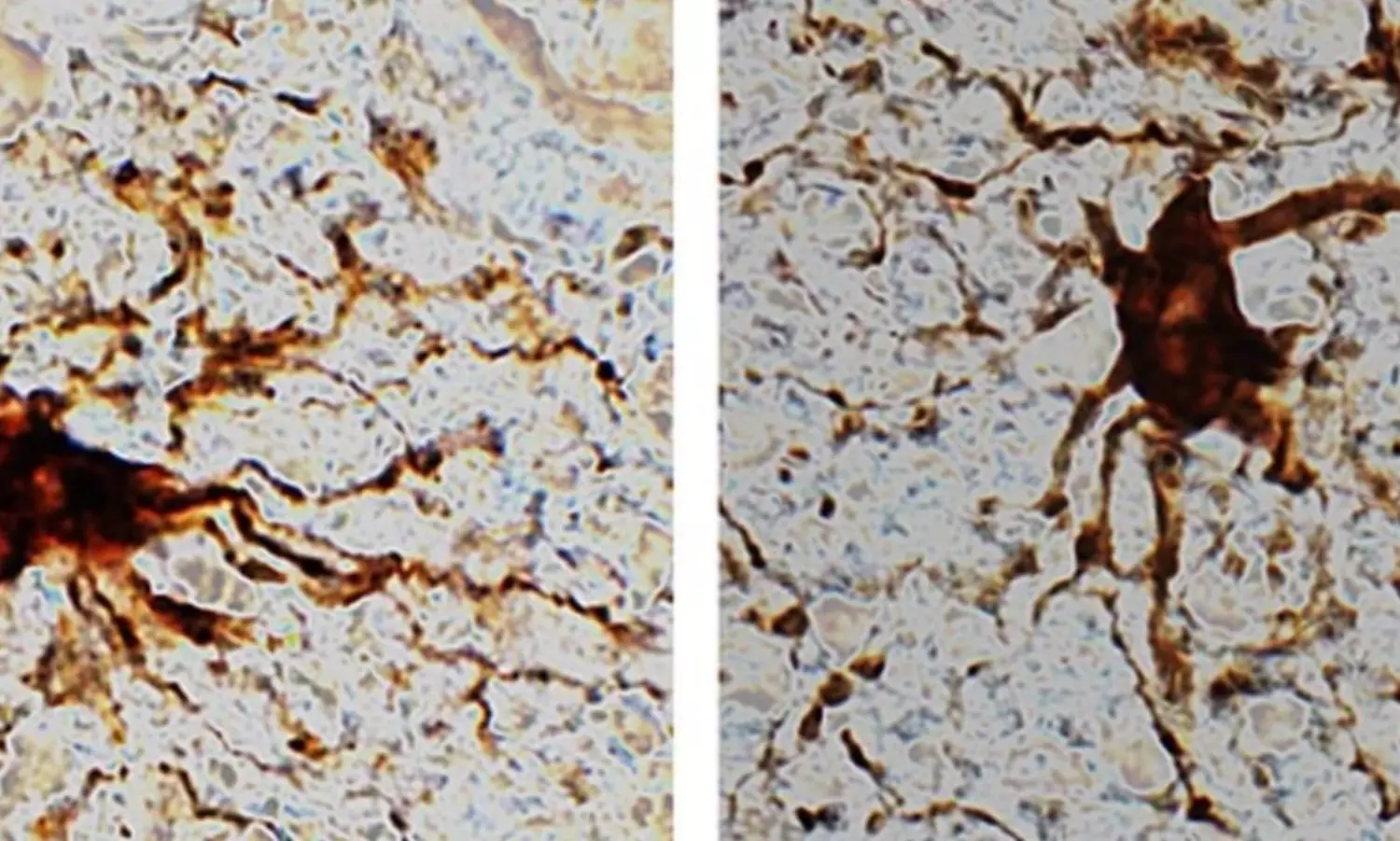 Zombie-cells exist in humans: Study