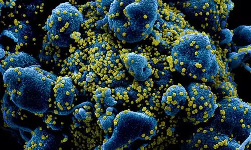US Scientists identify new mutant coronavirus, name it BV-1