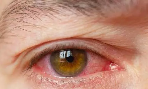 COVID also damages eye cells: New study claims