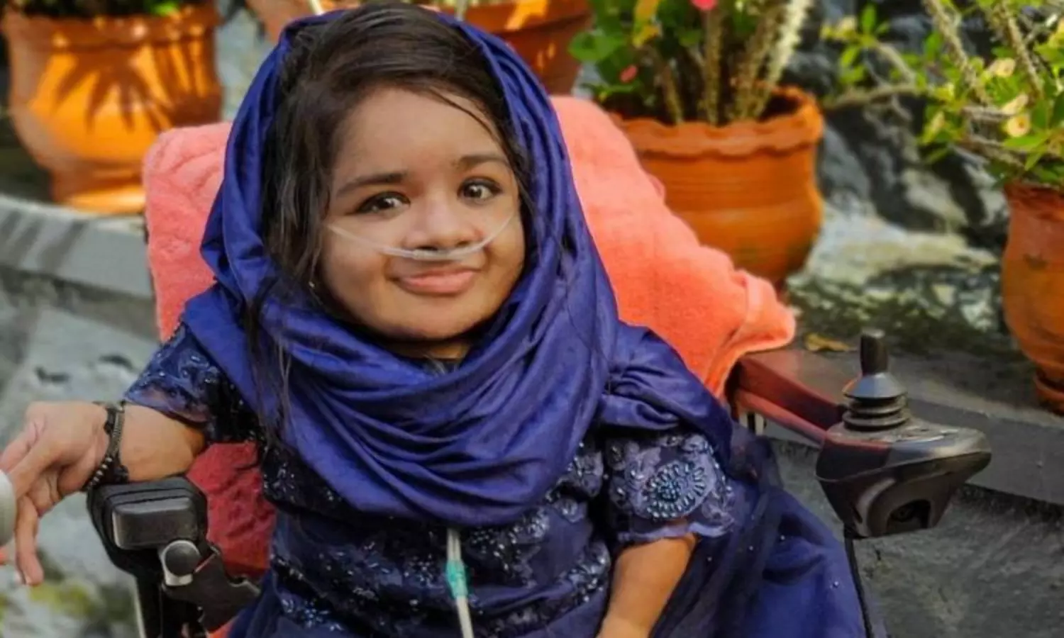 Woman with rare disease who appeared UPSC exam with Oxygen Cylinder dies