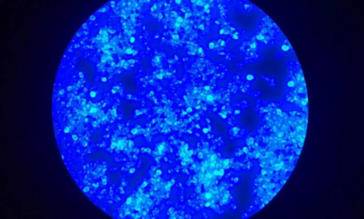 Covid-19 causes an outbreak of superfungus Candida Auris in Brazil