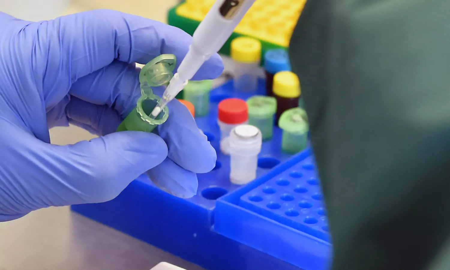 Quality accreditation for Covid-19 labs may have faltered, reports suggest