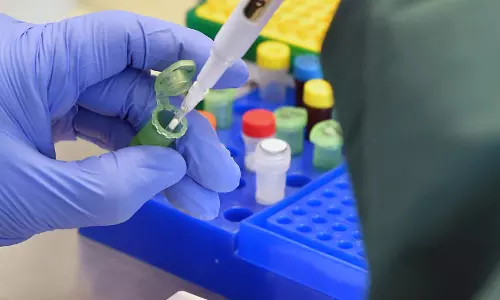 Quality accreditation for Covid-19 labs may have faltered, reports suggest