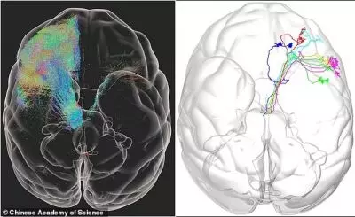 Worlds first high-resolution 3D image of monkey brain developed