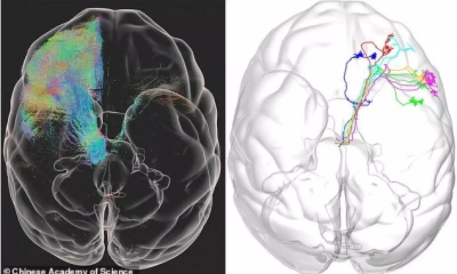 Worlds first high-resolution 3D image of monkey brain developed