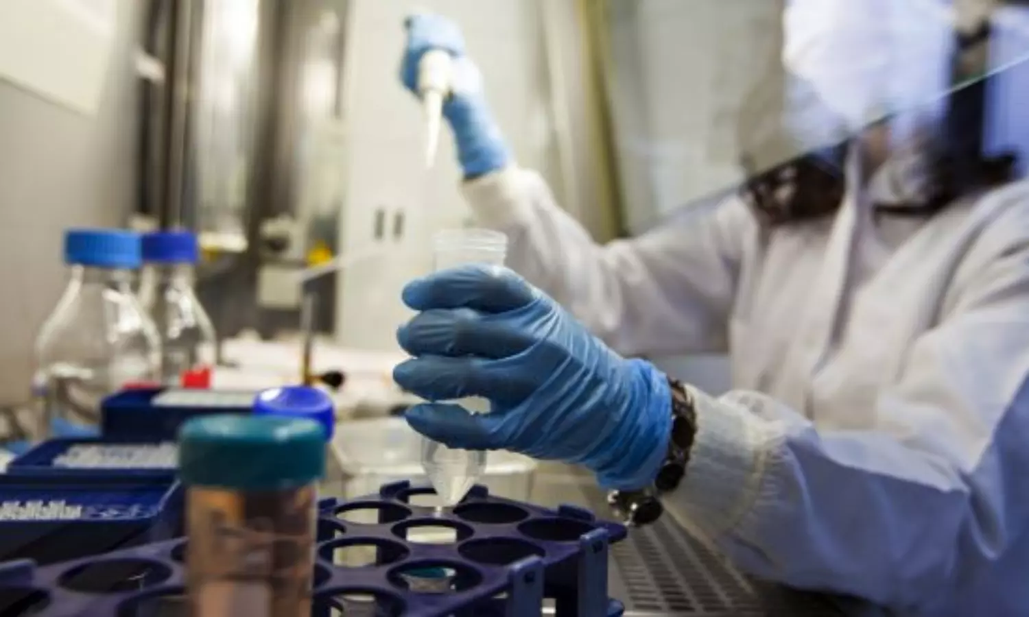 Guinea confirms first Ebola virus-induced Marburg disease: WHO