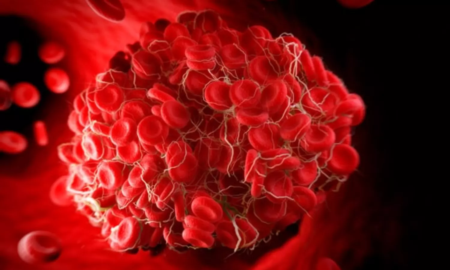 Though rare, blood clotting from vaccine likely to be devastating: Study