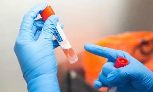 US FDA authorises third COVID shot for people with weak immune system