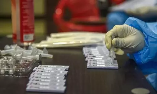 RT-PCR tests: are the prices still too high?