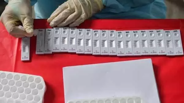 Govt puts curb on export of COVID rapid antigen testing kits
