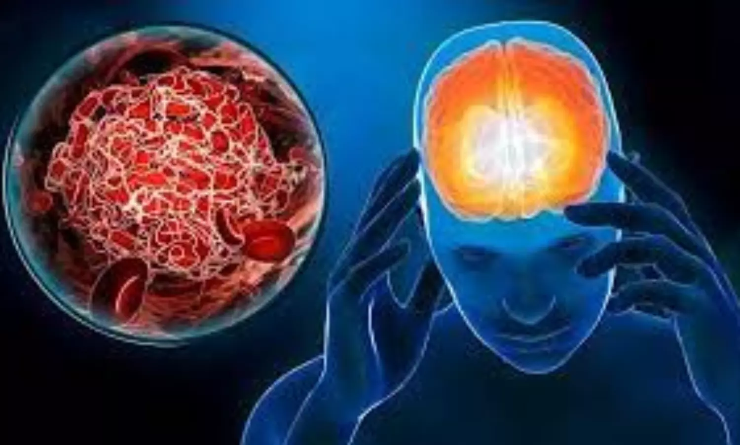 UK study finds higher blood clot risk from Covid than vaccines