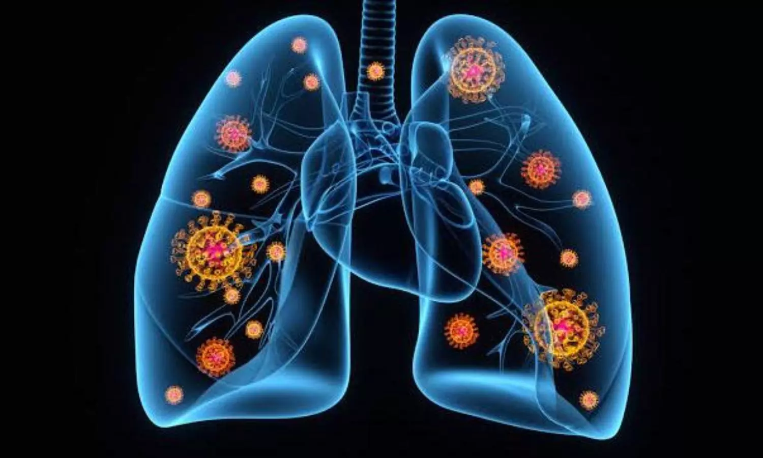 New study finds Covid-19 as vascular condition, not respiratory illness
