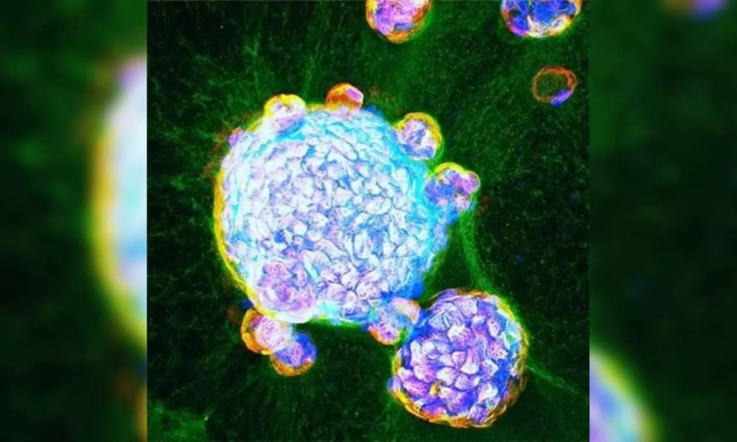 US researchers grow mini human lungs in lab for testing COVID treatments