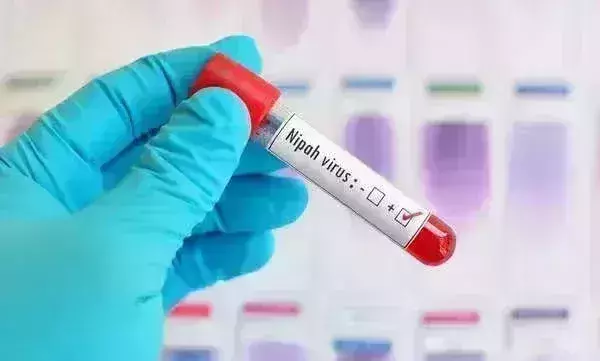 Truenat test kit gets DCGI nod for Nipah virus testing