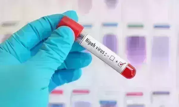 Truenat test kit gets DCGI nod for Nipah virus testing