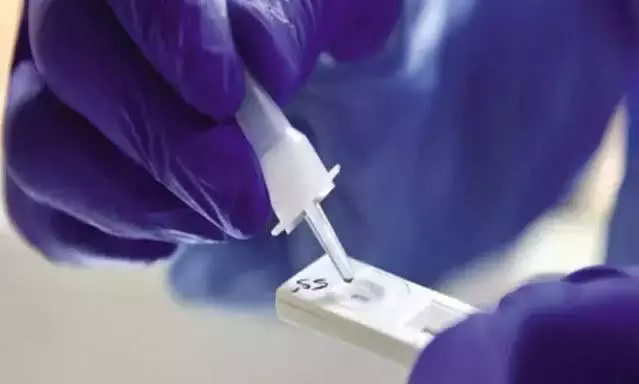 Mumbai lab develops worlds first Silicosis rapid test kit Mumbai lab develops worlds first Silicosis rapid test kit