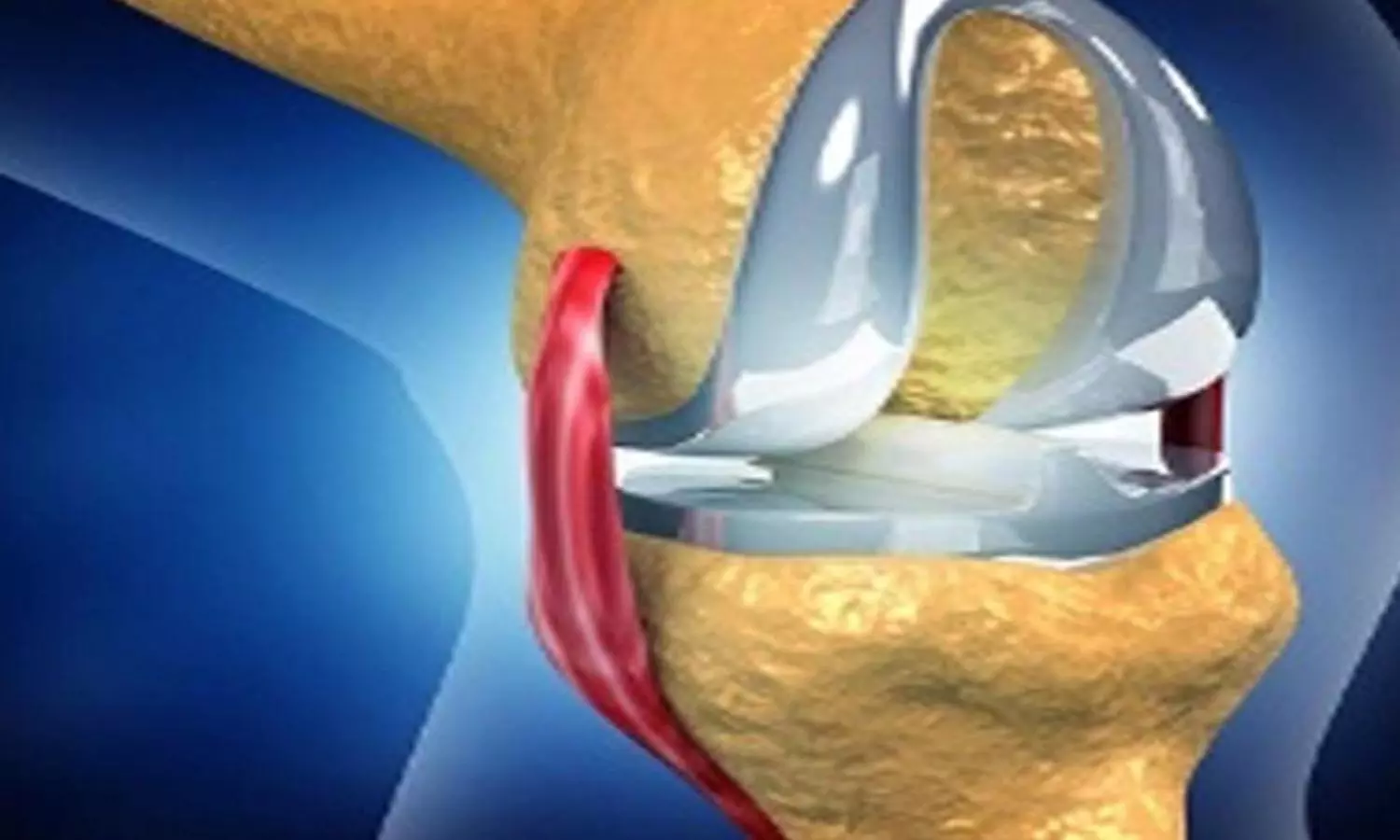 Indian scientists develop models to help improve hip, knee implants