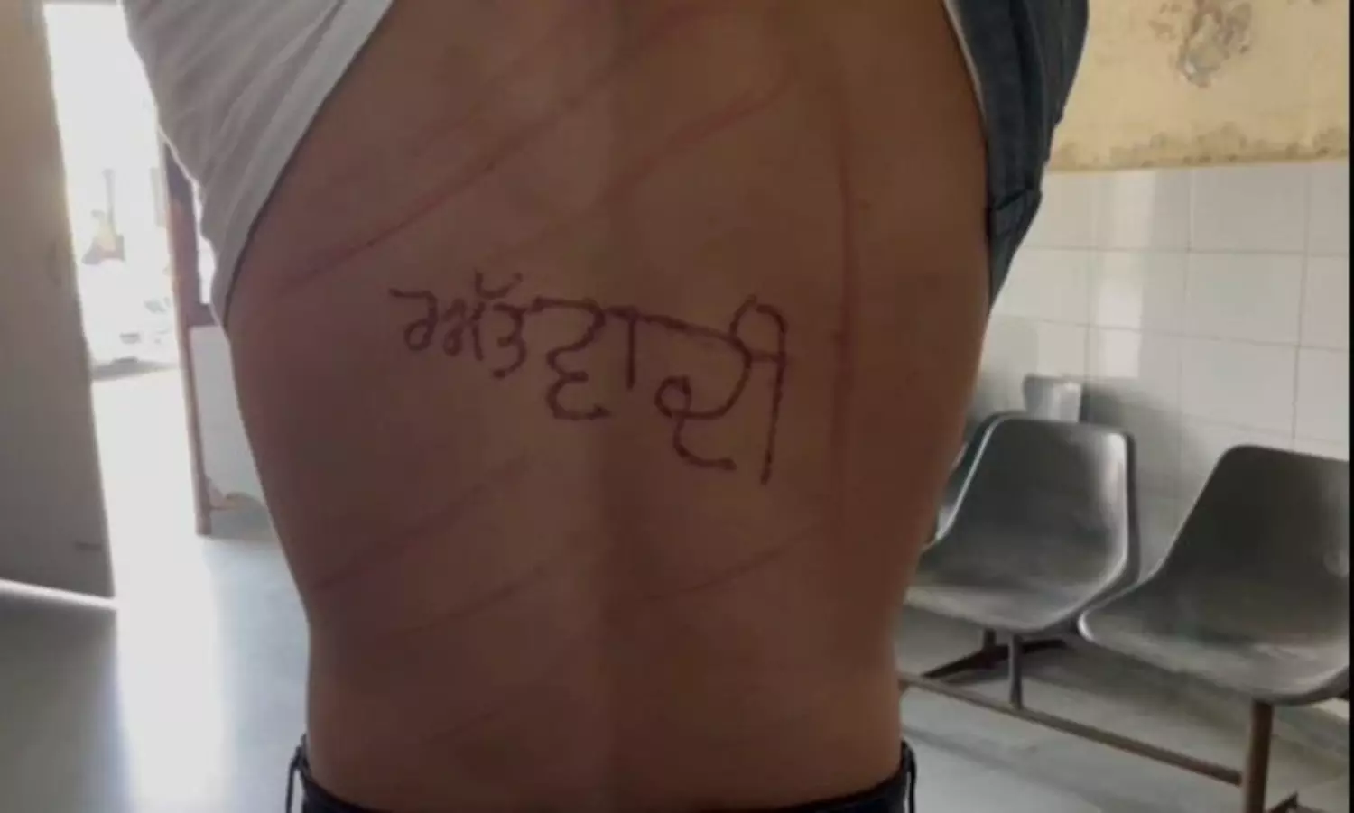 Stamped Terrorist on back: Prisoner alleges torture in Punjab jail