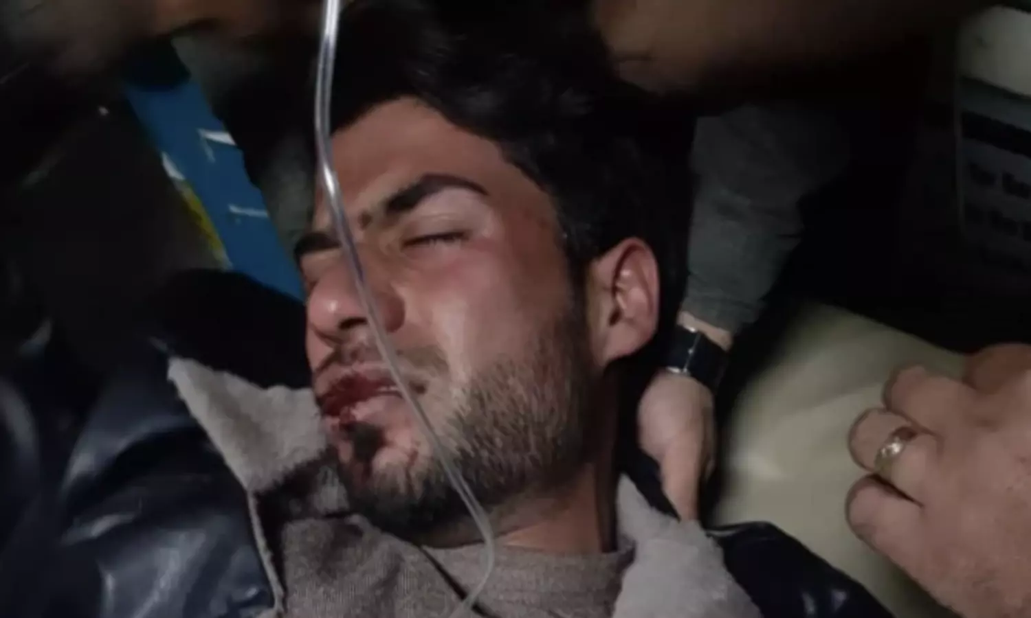 Assault on Ahmad Baseer: Journalists body says Taliban failed to protect press freedom