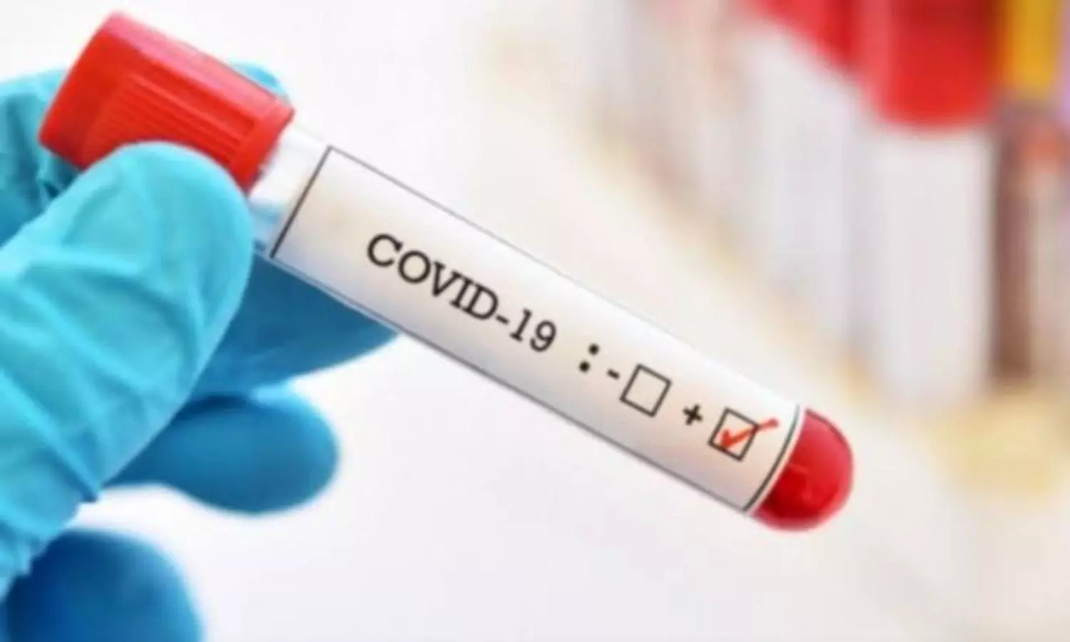 "Deltacron" infection combining Omicron and Delta found in Cyprus