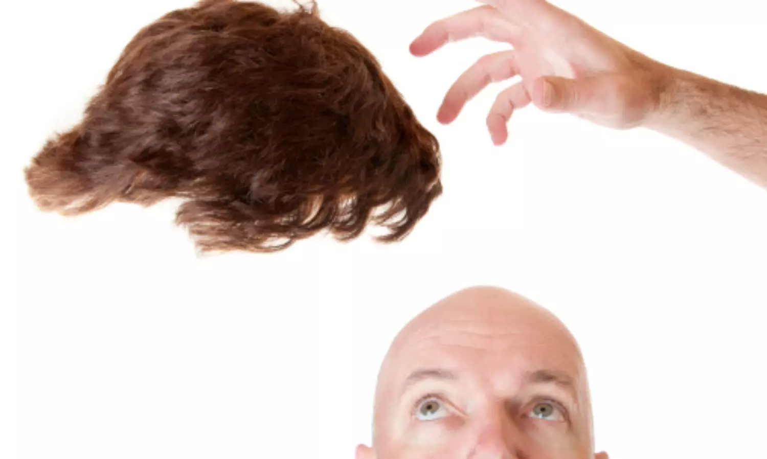 UP bride stands up bold against marrying a bald man