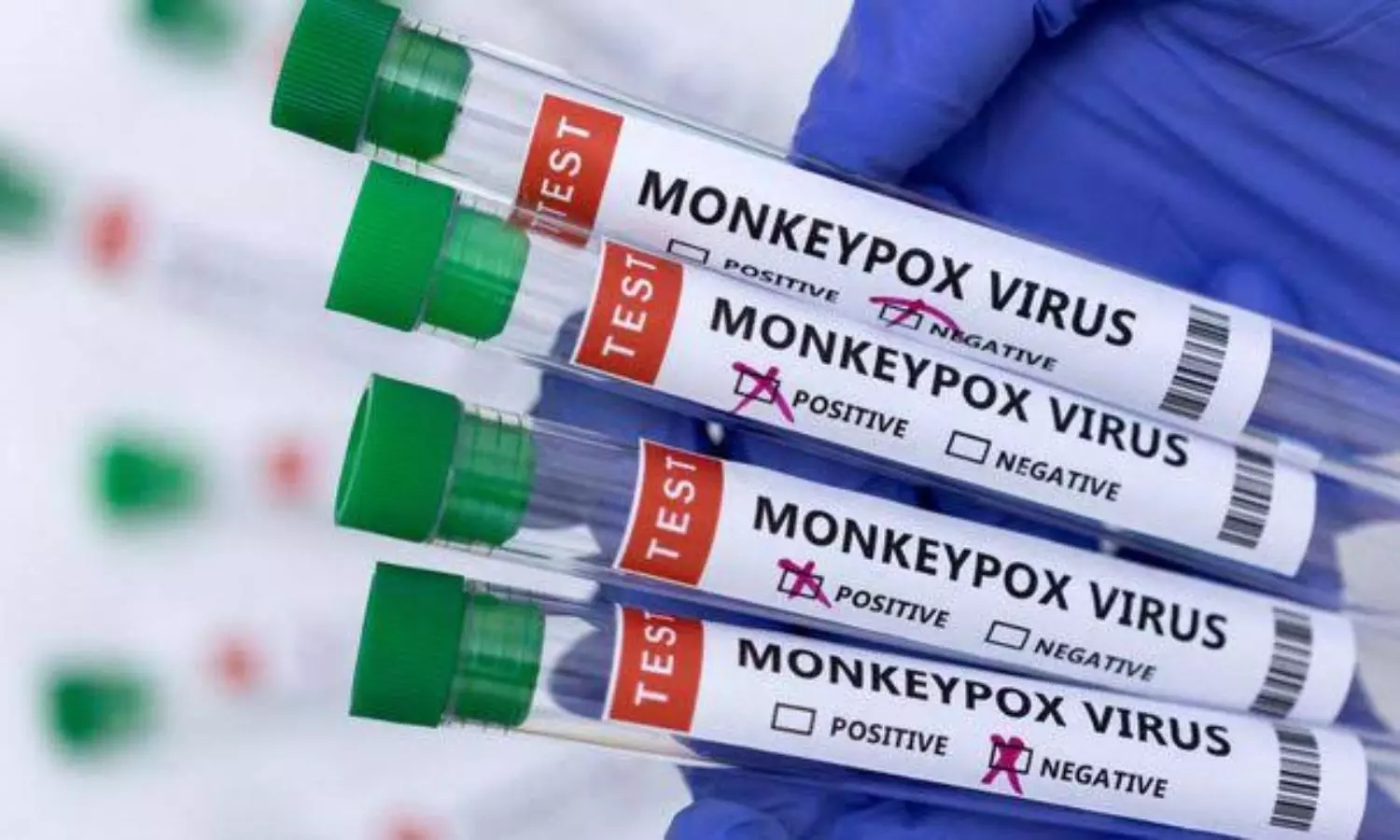 780 monkeypox outbreak cases reported from 27 countries as of June 2: WHO