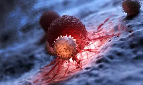 Experimental drug clears tumors of rectal cancer patients in small trial