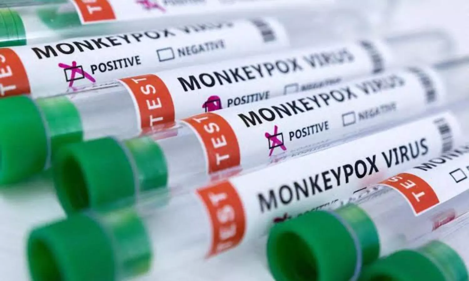 Kerala youth who died Saturday had tested positive for Monkeypox in UAE; sample test underway