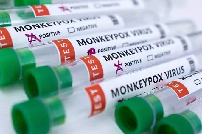 Kerala youth who died Saturday had tested positive for Monkeypox in UAE; sample test underway