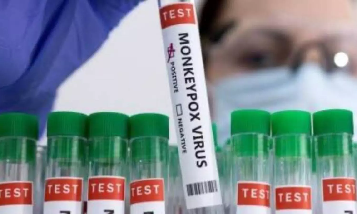 Monkeypox: Kerala confirms states 5th case of virus in 30-year-old UAE returnee