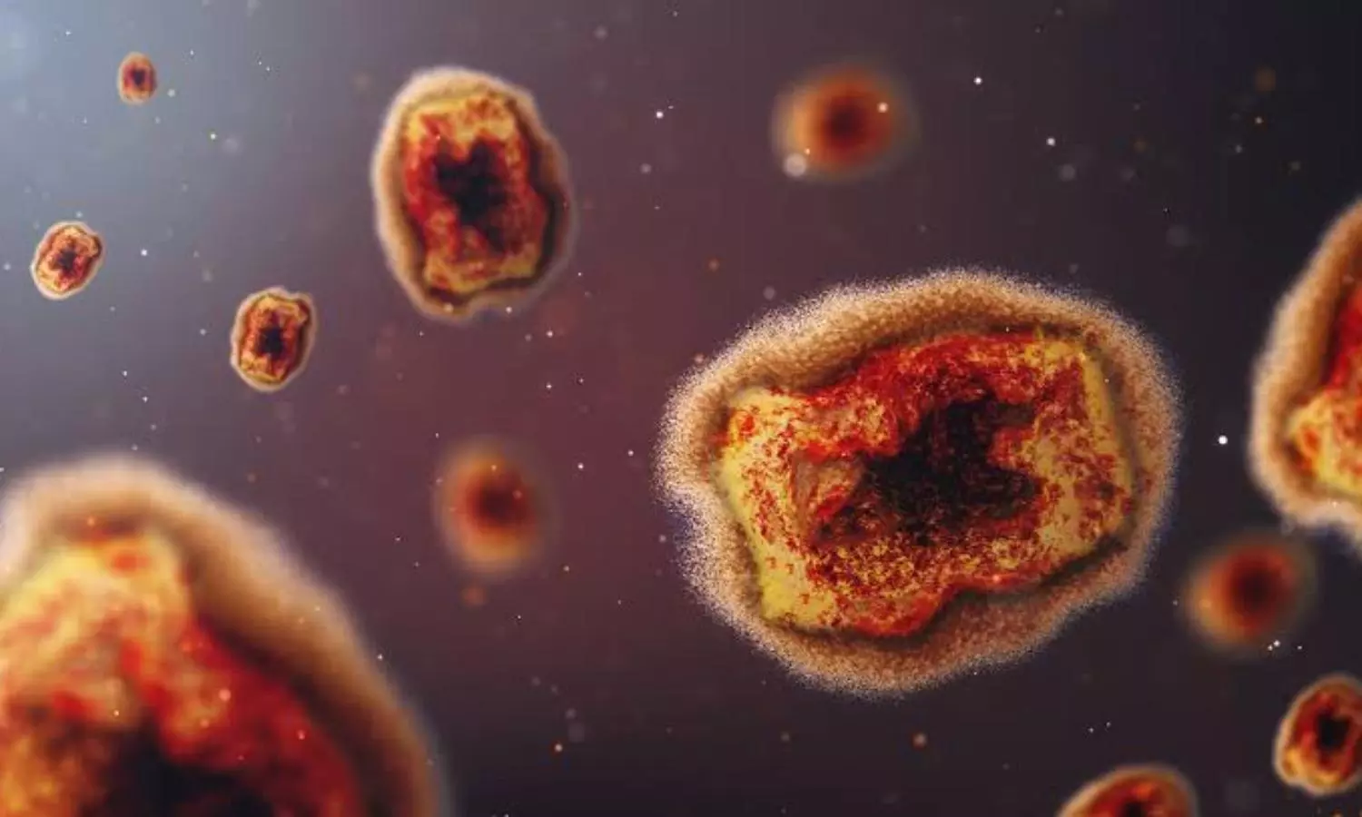 New monkeypox strain discovered in UK, patient hospitalized
