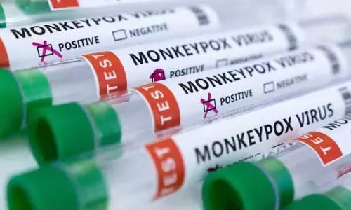 Dont touch foreigners: Chinese health officials advice to curb Monkeypox triggers massive row