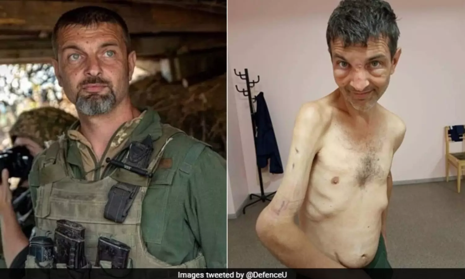 Before and after photos of captured Ukraine soldier shocks social media
