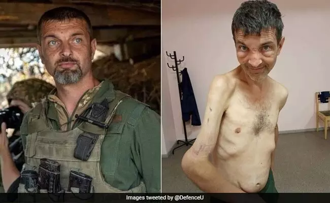 Before and after photos of captured Ukraine soldier shocks social media