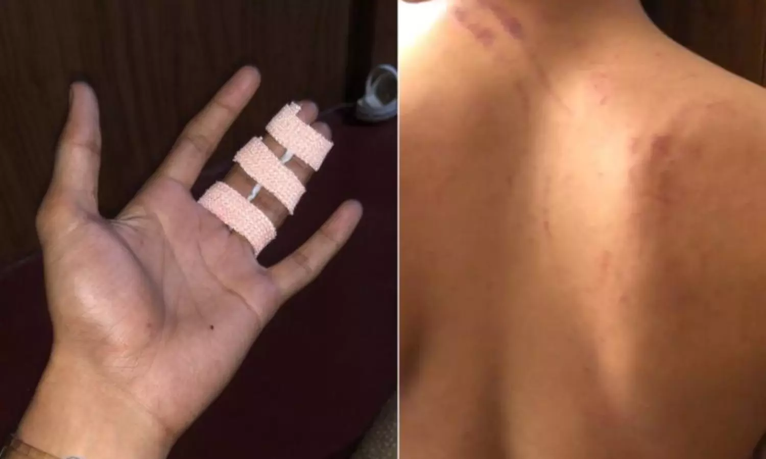 Ragging in Kerala: youth gets brutally beaten; eardrum damaged