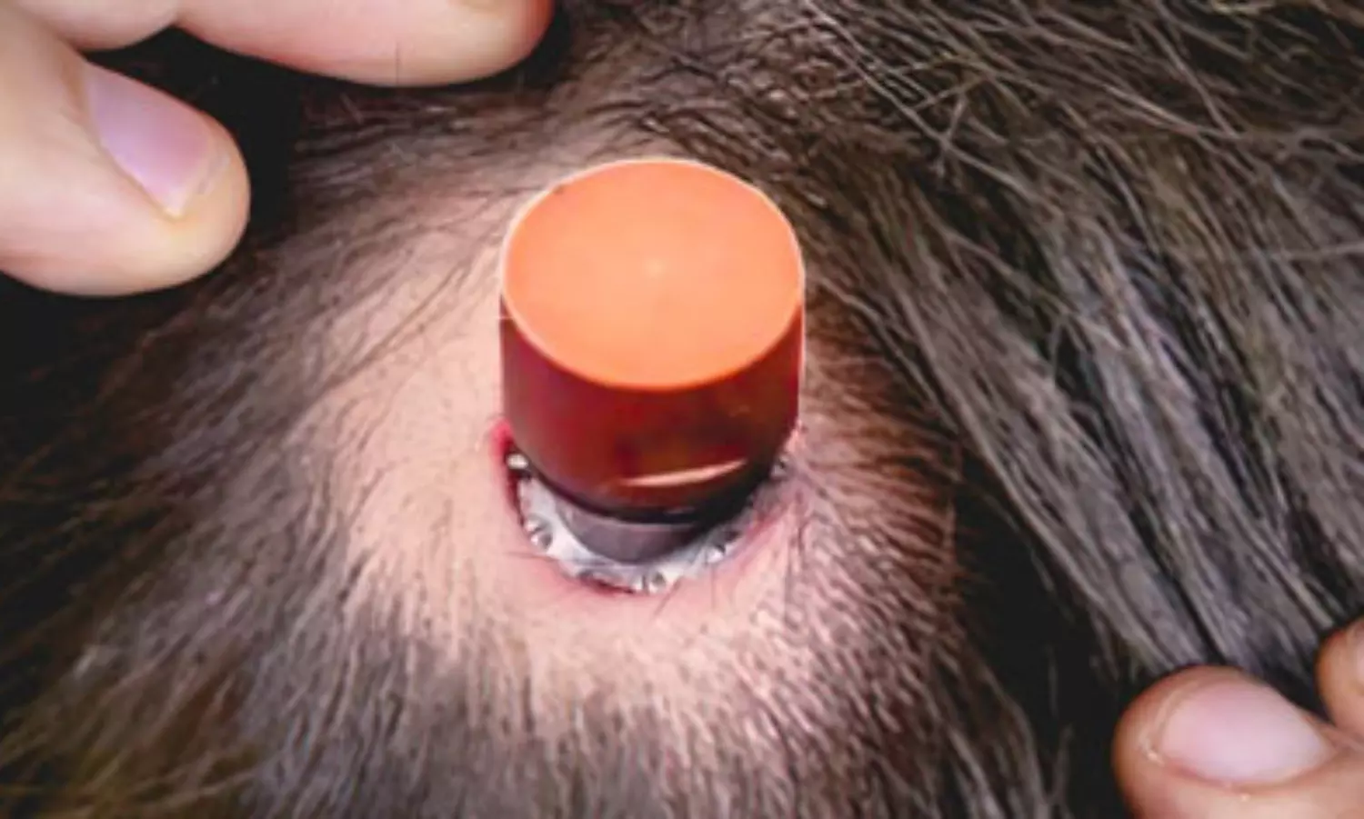 Elon Musk to implant brain chip on himself too, as part of its test on humans