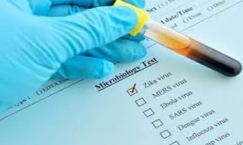 Karnataka reports first case of Zika virus, five year old girl tested positive