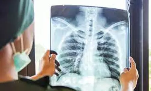 Identification and Management of Depression in TB-infected Individuals
