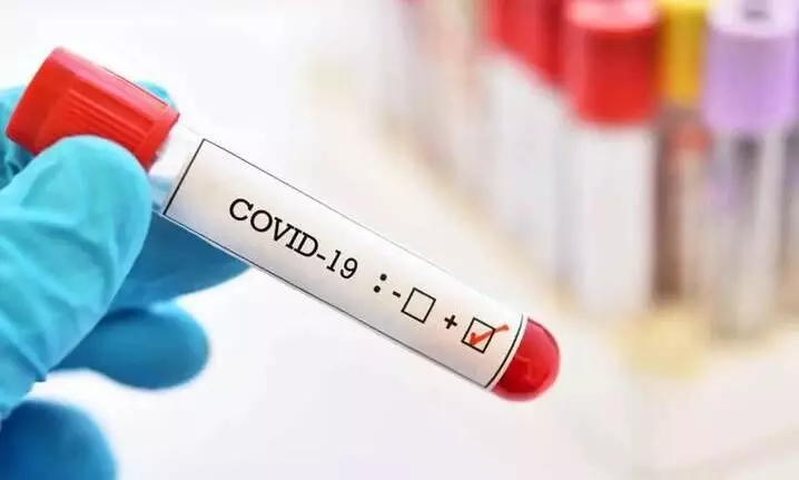 Covid-19 virus escaped from Chinese laboratory: US report