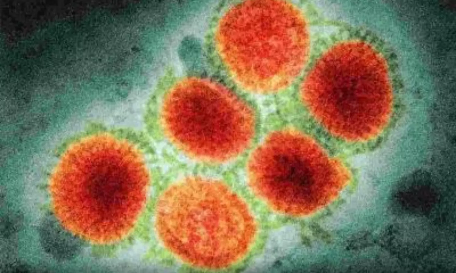 Another human case of influenza A H3N8 detected in Chinas Guangdong province